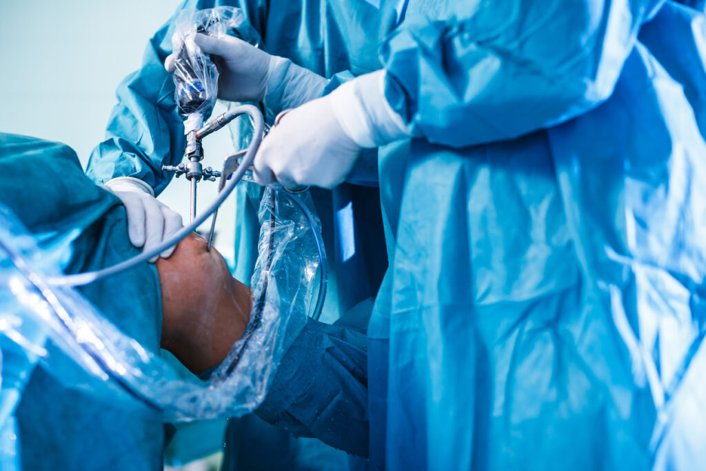 Endoscopy Surgical Device